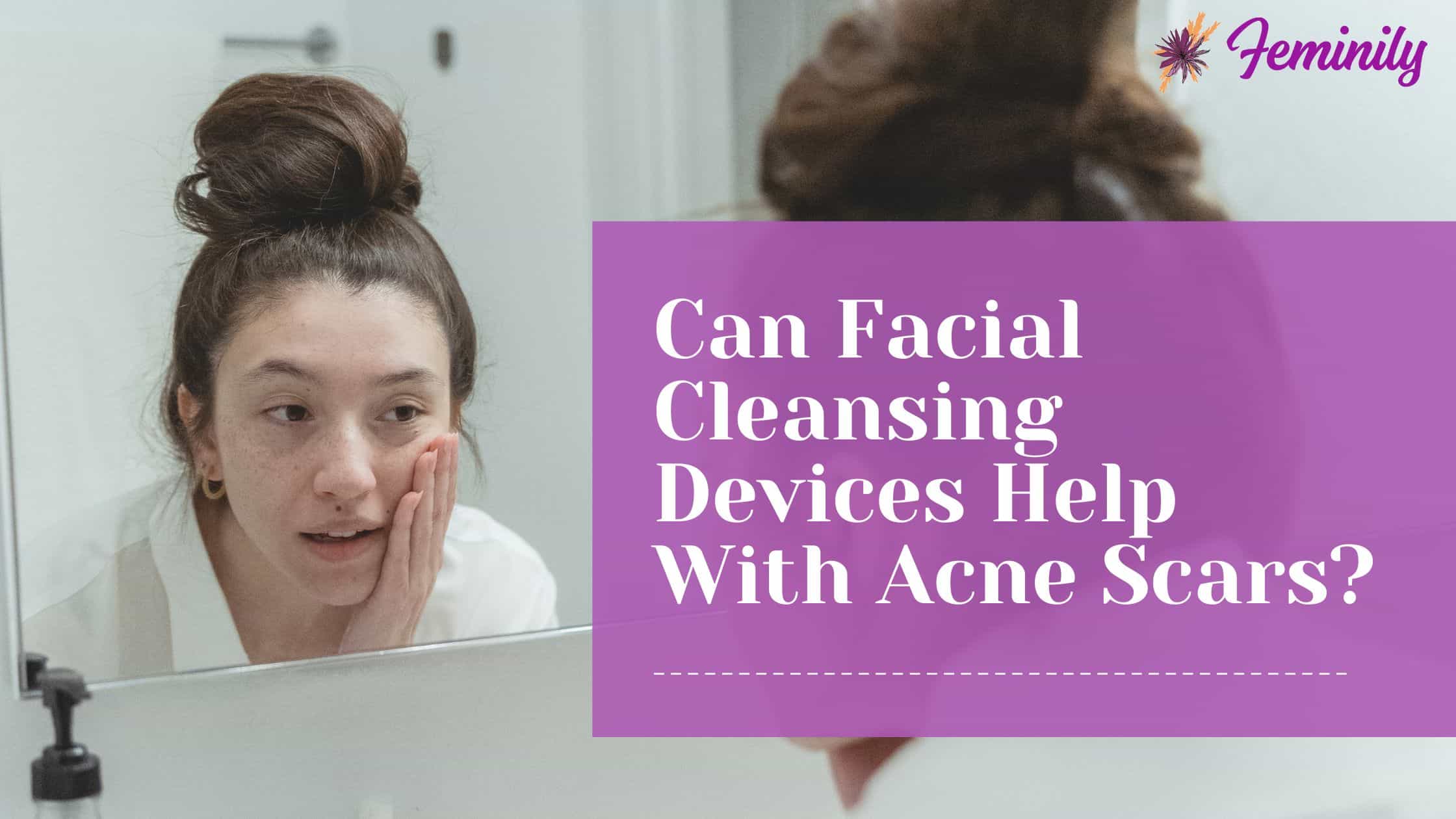 Can facial cleansing devices help with acne scars